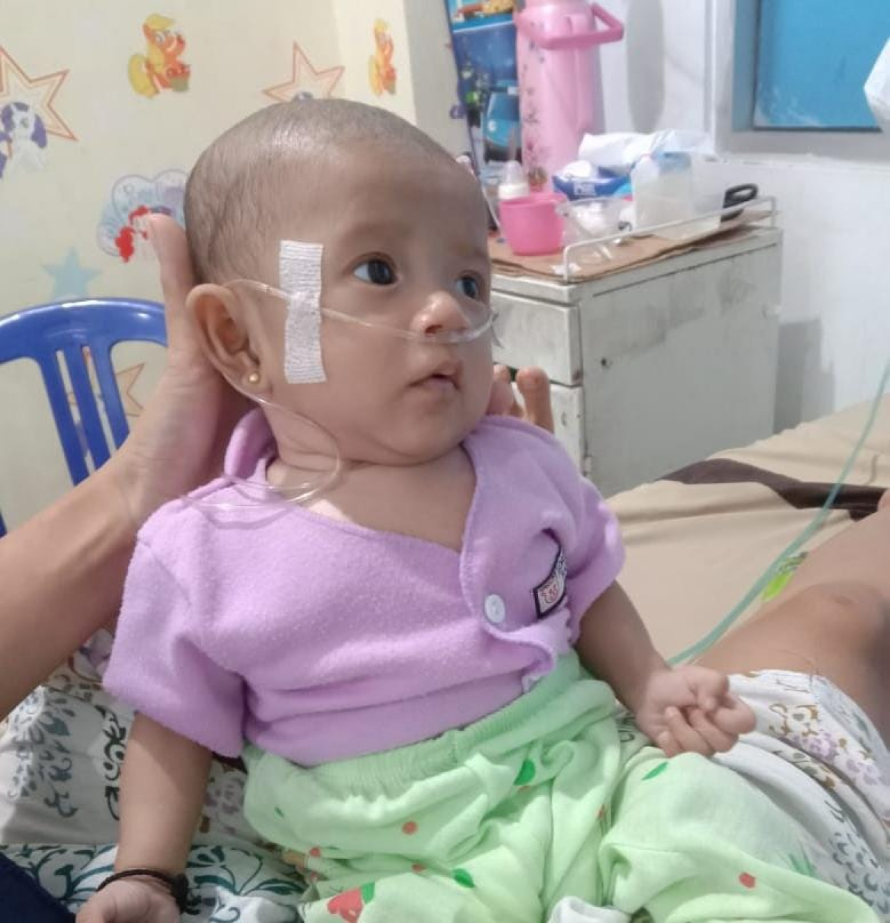 Bayi Mungil asal Tanggamus, Haura Al-Maira Berjuang Melawan Jantung Bocor, Butuh Uluran Tangan Dermawan